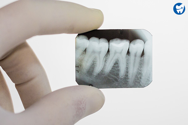 DENTAL X-RAY at Careful Diagnostic Centre 