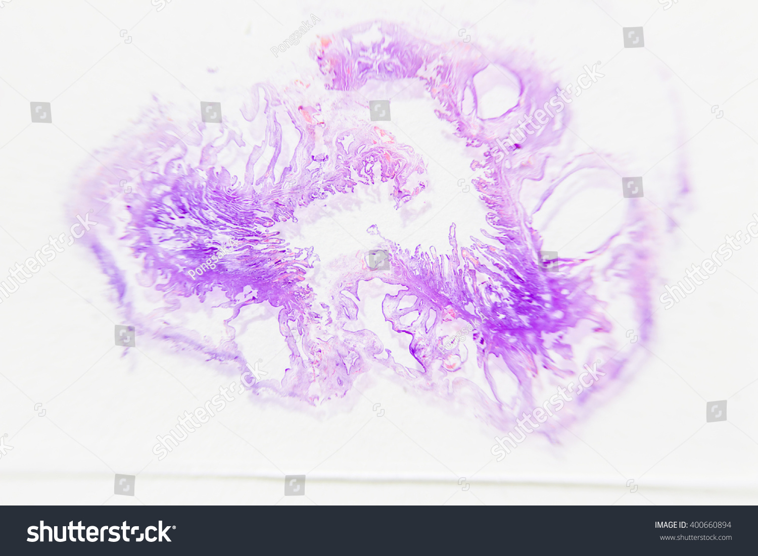 BIOPSY at Careful Diagnostic Centre 